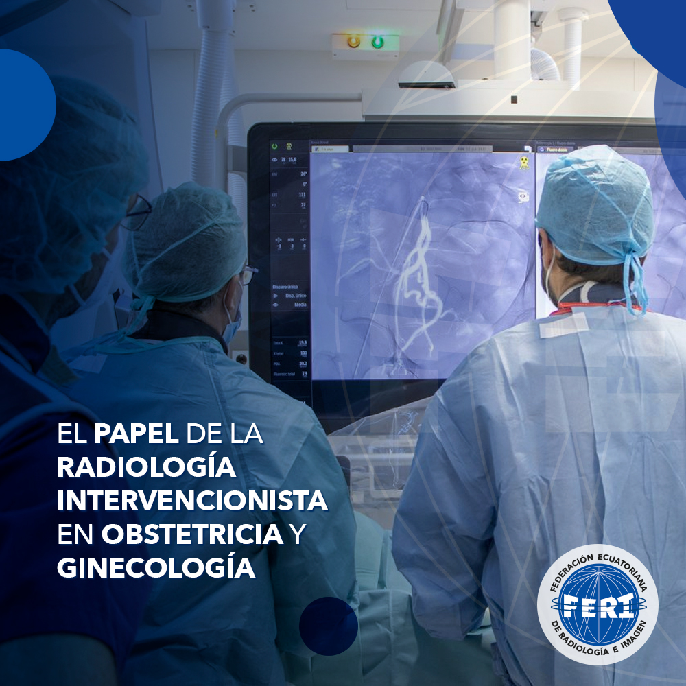 El Papel de la Radiología Intervencionista en Obstetricia y Ginecología