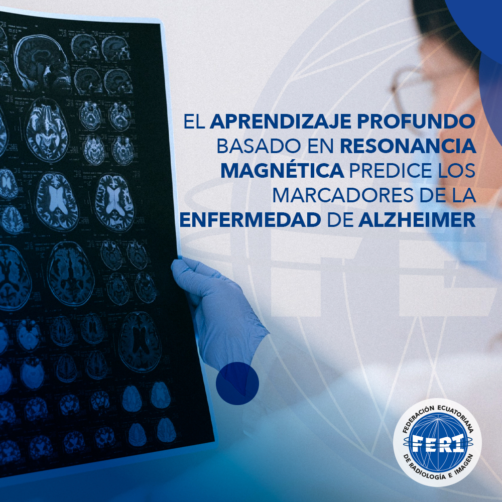 El aprendizaje profundo basado en resonancia magnética predice los marcadores de la enfermedad de Alzheimer