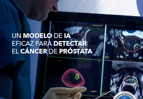 Un modelo de IA eficaz para detectar el cáncer de próstata