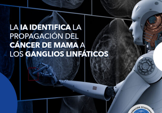 La IA identifica la propagación del cáncer de mama a los ganglios linfáticos