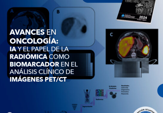 Avances en Oncología: IA y el papel de la radiómica como biomarcador en el análisis clínico de imágenes PET/CT