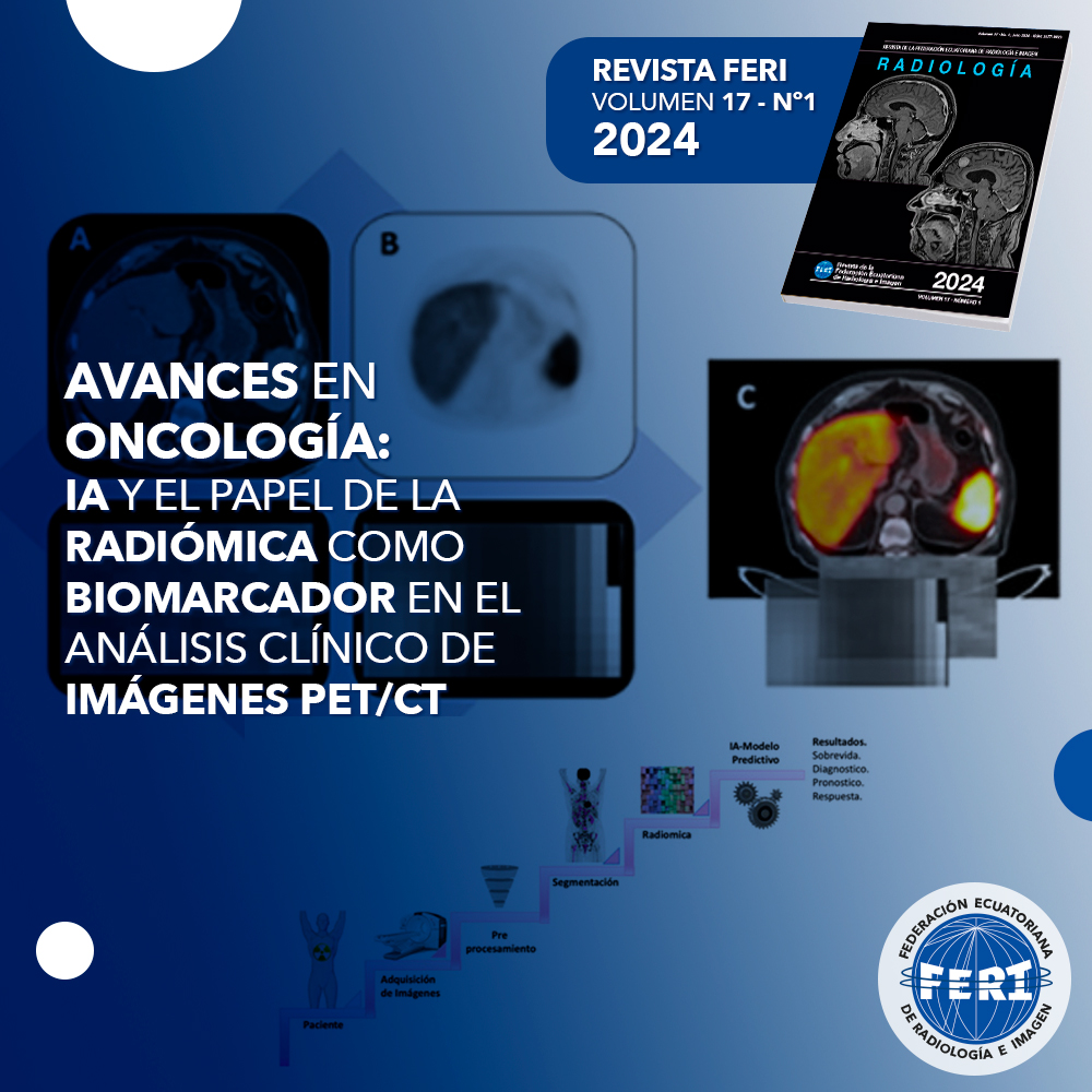 Avances en Oncología: IA y el papel de la radiómica como biomarcador en el análisis clínico de imágenes PET/CT